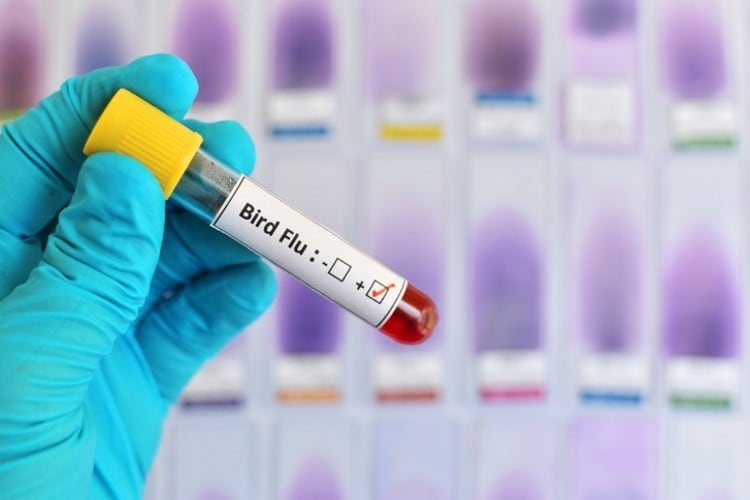 China hit with human case of avian influenza