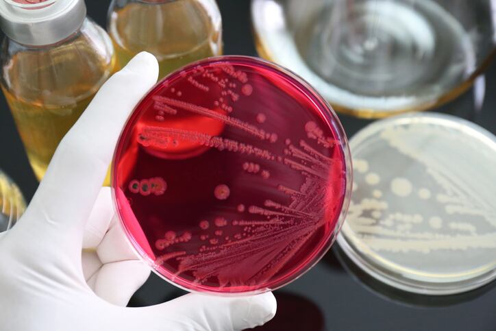 Bacteria barcode: Researchers develop new method to trace salmonella outbreaks
