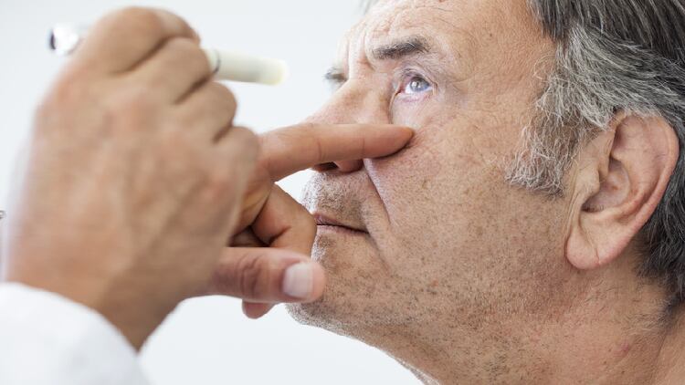 Vitamin C for cataract prevention? Benefits only likely in populations with low baseline levels - Study 