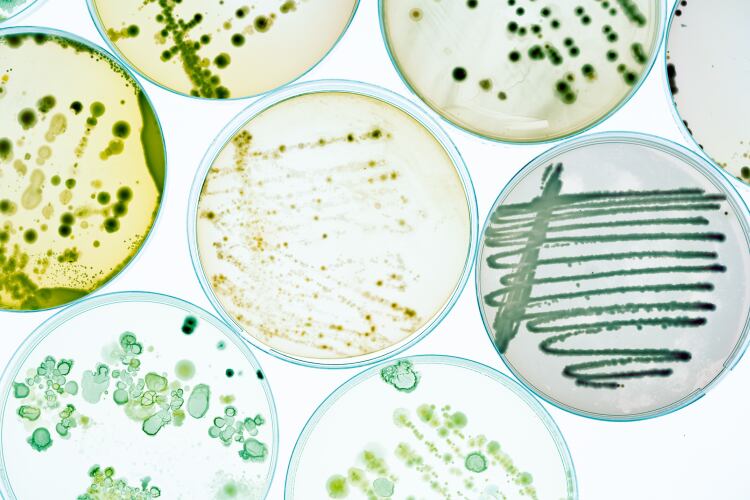 GettyImages-luchschen-microbial-microbes-petri-dishes-safety-contamination.png