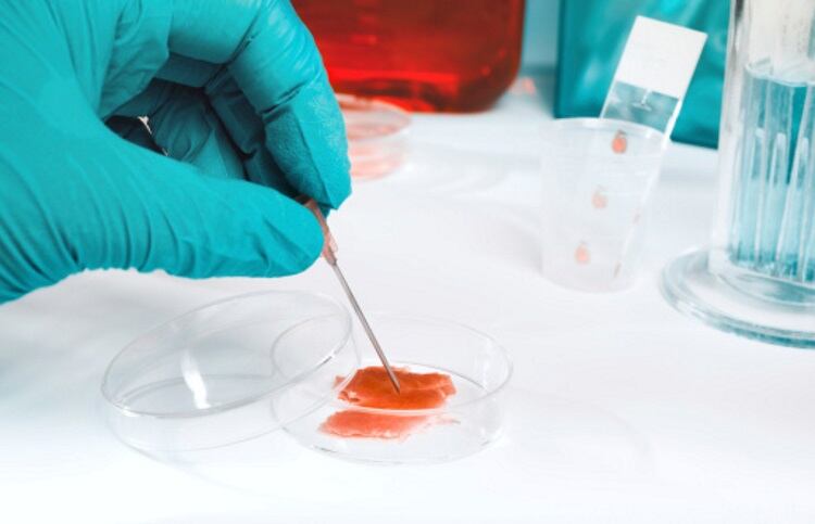 Grant offered to lab-grown kangaroo meat start-up