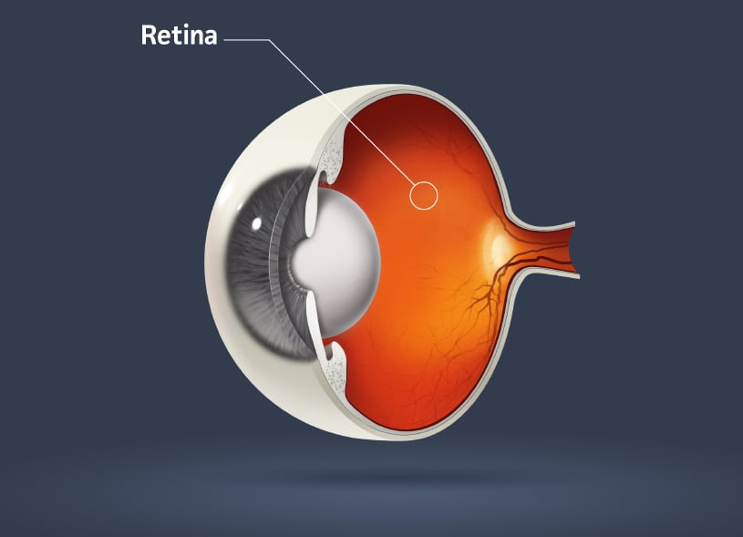eye-retina.jpg
