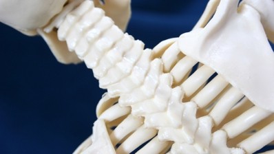 SE Asian women concerned about bone health but shun beneficial diet