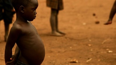 Research to prove that more food is not the solution to malnutrition