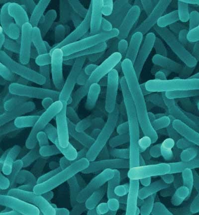 Trans-Tasman body to review Listeria monocytogenes levels in foods