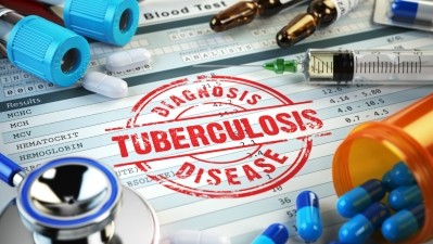 Recent reports revealed 17,000 new TB cases annually in Telangana, with 6,000 new cases in its capital Hyderabad alone. ©Getty Images