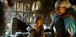 “We are in a race against time to eradicate the global scourge of undernutrition”